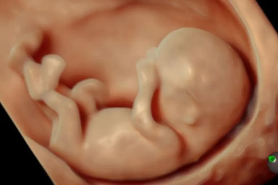 ¿Cómo se verán los bebés en una ecografía 6D?