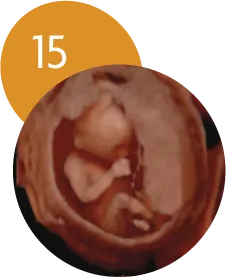 Ecografía 5D en la semana 15 de embarazo