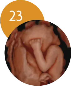 Ecografía 5D en la semana 23 de embarazo