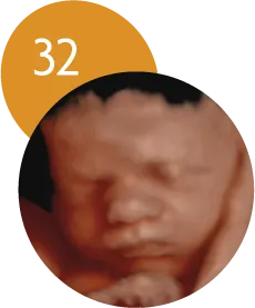 Ecografía 5D en la semana 32 de embarazo