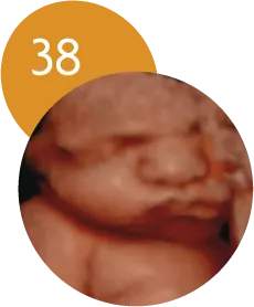 Ecografía 5D en la semana 38 de embarazo
