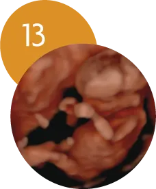 Ecografía 5D en la semana 13 de embarazo