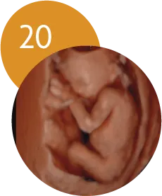 Ecografía 5D en la semana 20 de embarazo