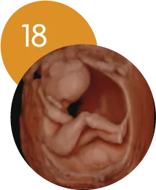 Ecografía 5D en la semana 18 de embarazo