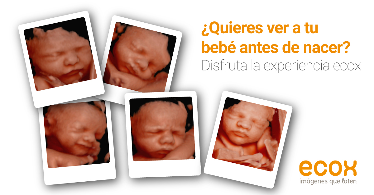 ¿Quieres ver a tu bebé antes de nacer? Disfruta la experiencia ecox