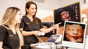 Ecografistas de Ecox realizando una sesión de ecografía 5D con imagen del bebé en pantalla